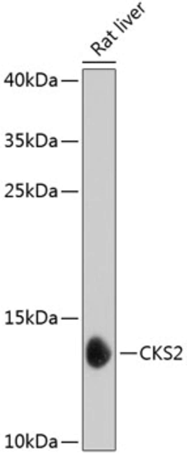 100UL CKS2 ANTIBODY 100 ul