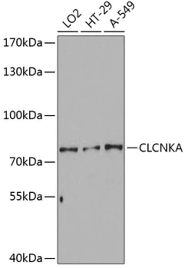 100UL CLCNKA ANTIBODY 100 ul