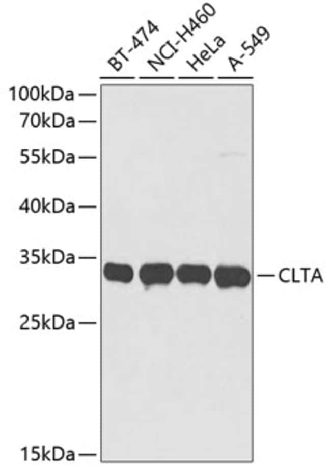 100UL CLATHRIN LIGHT CHAIN A ANTIBOD 100