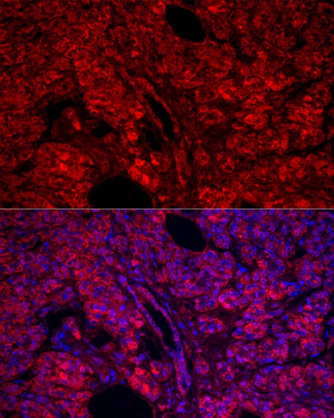 100UL CARBOXYPEPTIDASE A1 ANTIBODY 100 u