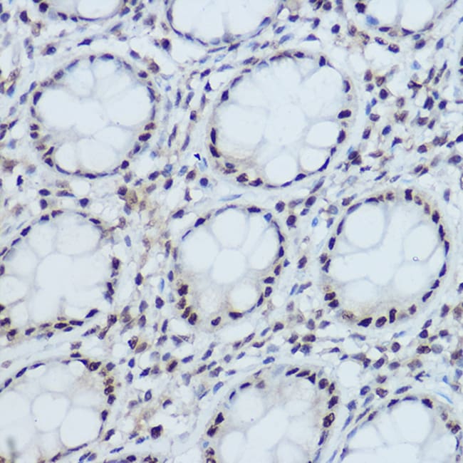 100UL DDB1 ANTIBODY 100 ul
