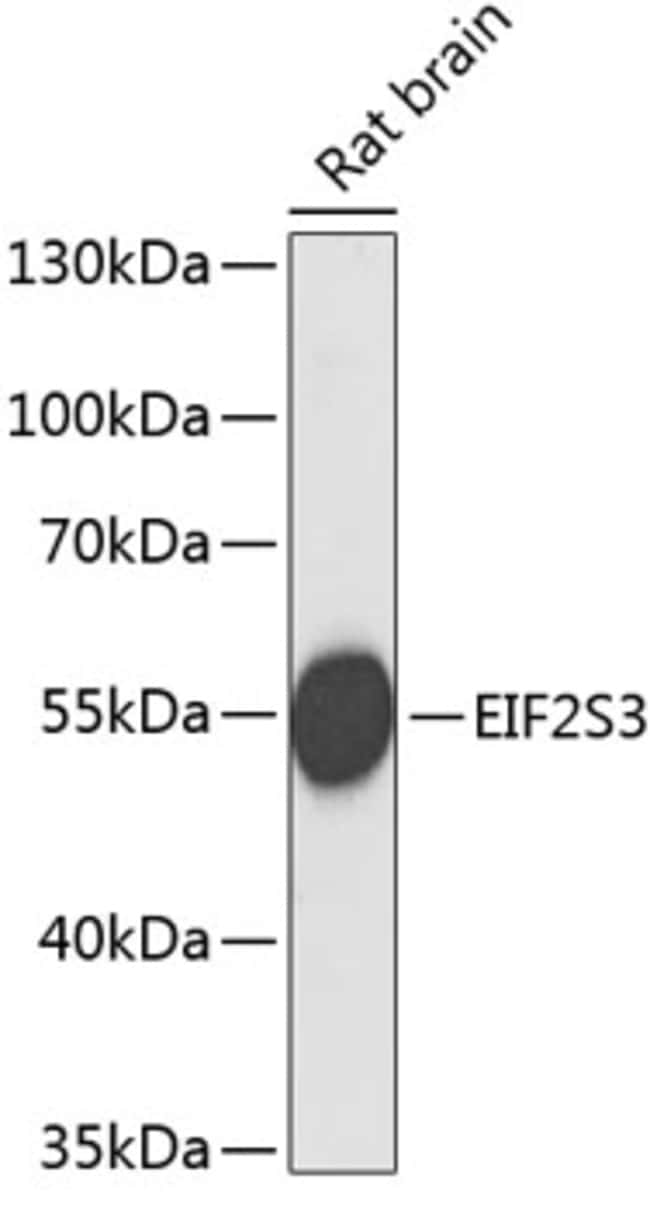 100UL EIF2 GAMMA ANTIBODY 100 ul