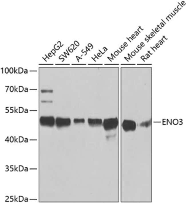 100UL ENO3 ANTIBODY 100 ul