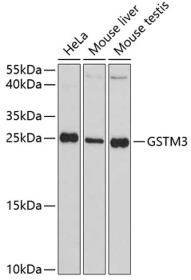 100UL GSTM3 ANTIBODY 100 ul