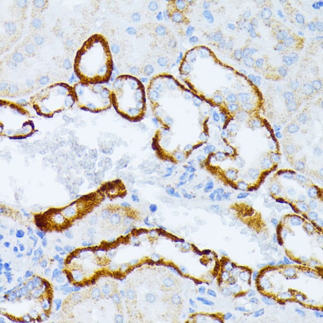 100UL CD123 ANTIBODY 100 ul