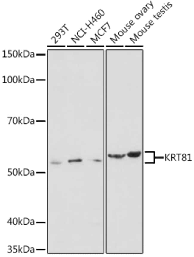 100UL KRT81 ANTIBODY 100 ul