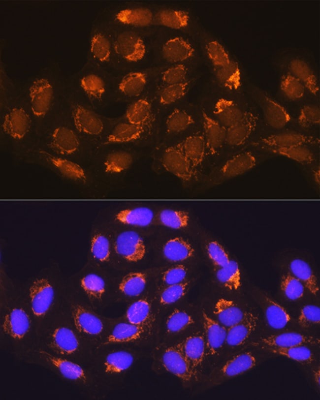 100UL MUT ANTIBODY 100 ul