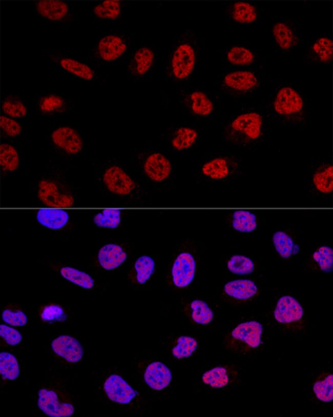 100UL BCAS2 ANTIBODY 100 ul