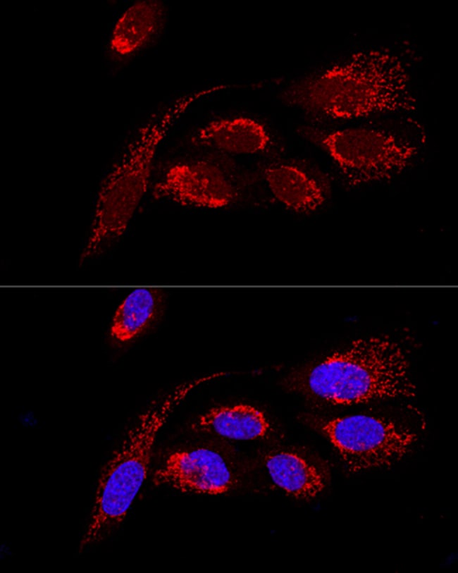 100UL ATP5H ANTIBODY 100 ul
