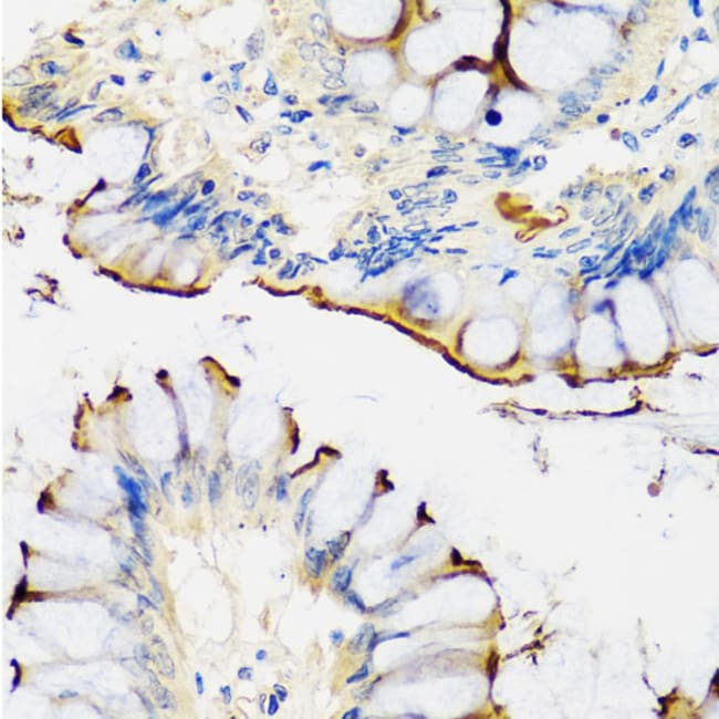 100UL CRTAP ANTIBODY 100 ul