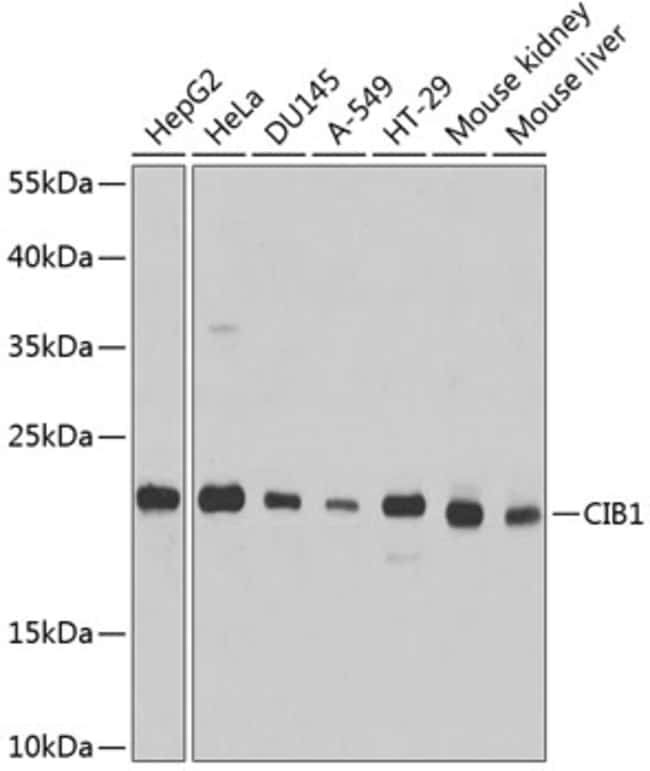 100UL CALMYRIN ANTIBODY 100 ul