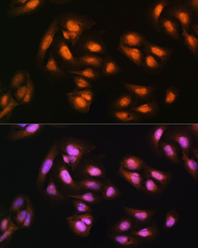 100UL ADRM1 ANTIBODY 100 ul