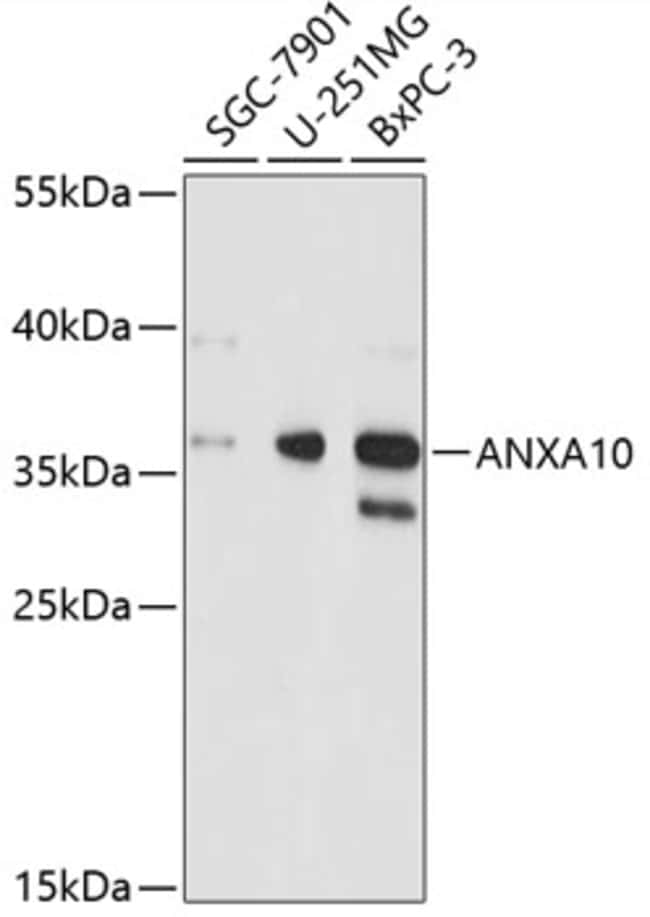 100UL ANNEXIN A10 ANTIBODY 100 ul