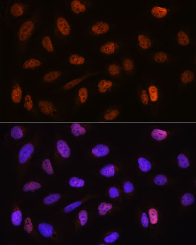 100UL CSTF2T ANTIBODY 100 ul