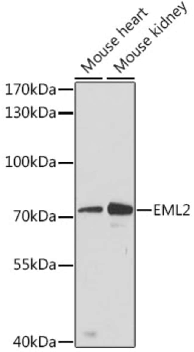 100UL EML2 ANTIBODY 100 ul