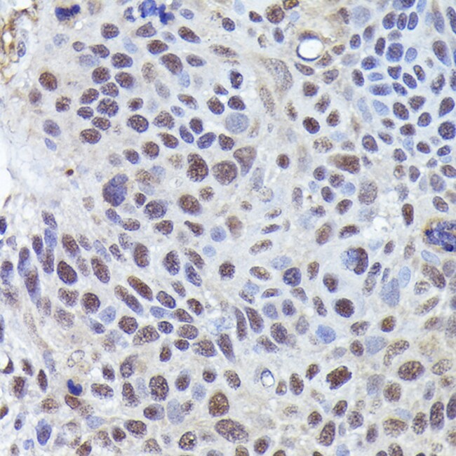 100UL CRCP ANTIBODY 100 ul