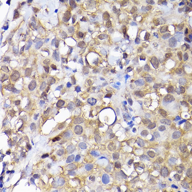 100UL ADI1 ANTIBODY 100 ul