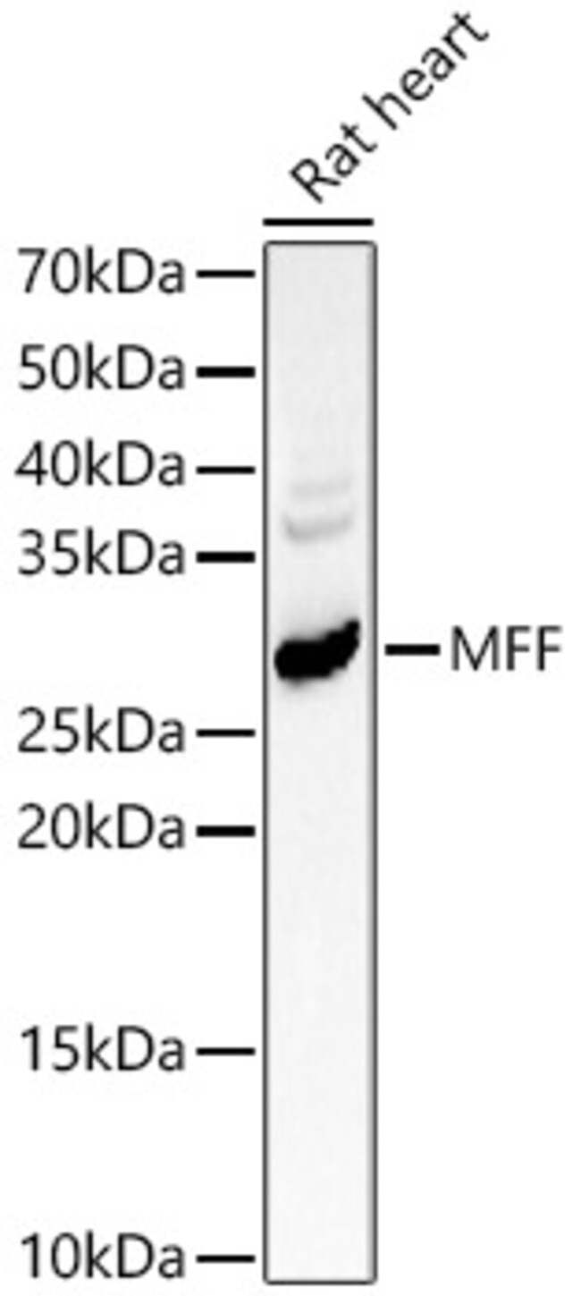 100UL C2ORF33 ANTIBODY 100 ul