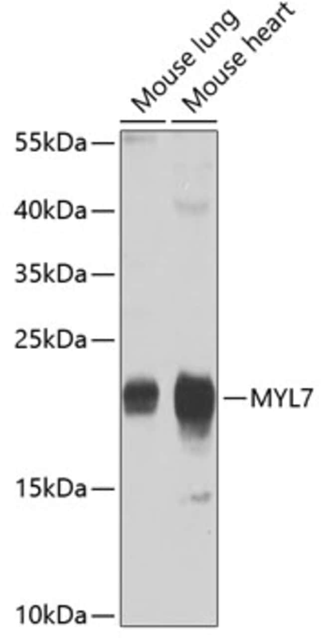 100UL MYL7 ANTIBODY 100 ul