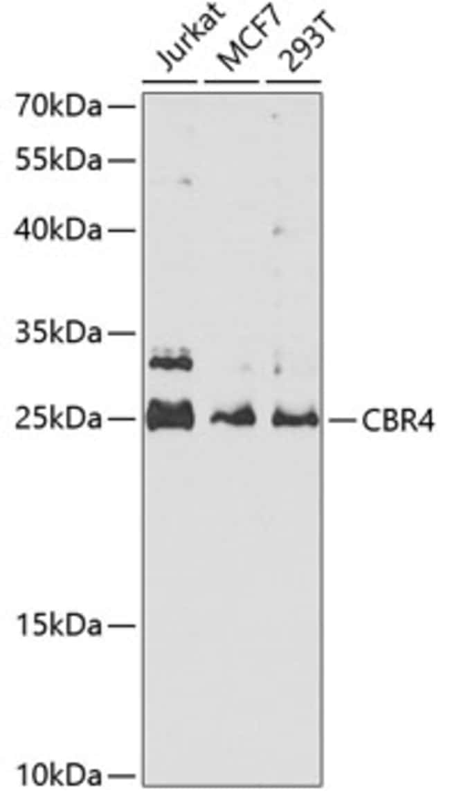 100UL CBR4 ANTIBODY 100 ul
