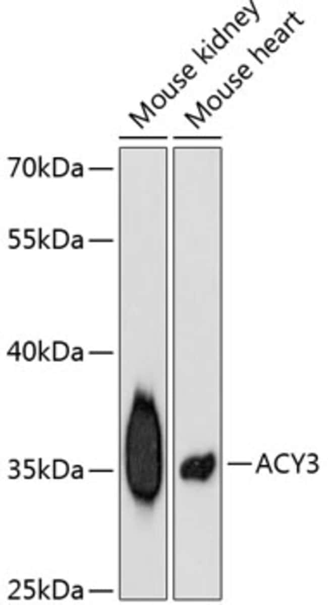100UL ACY3 ANTIBODY 100 ul