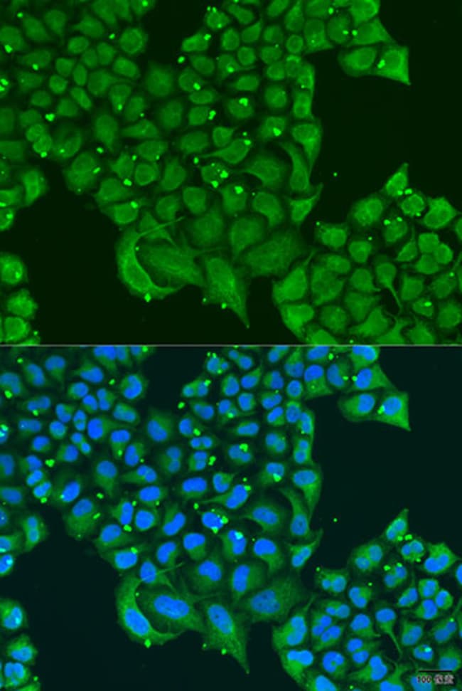 100UL ATPIF1 ANTIBODY 100 ul