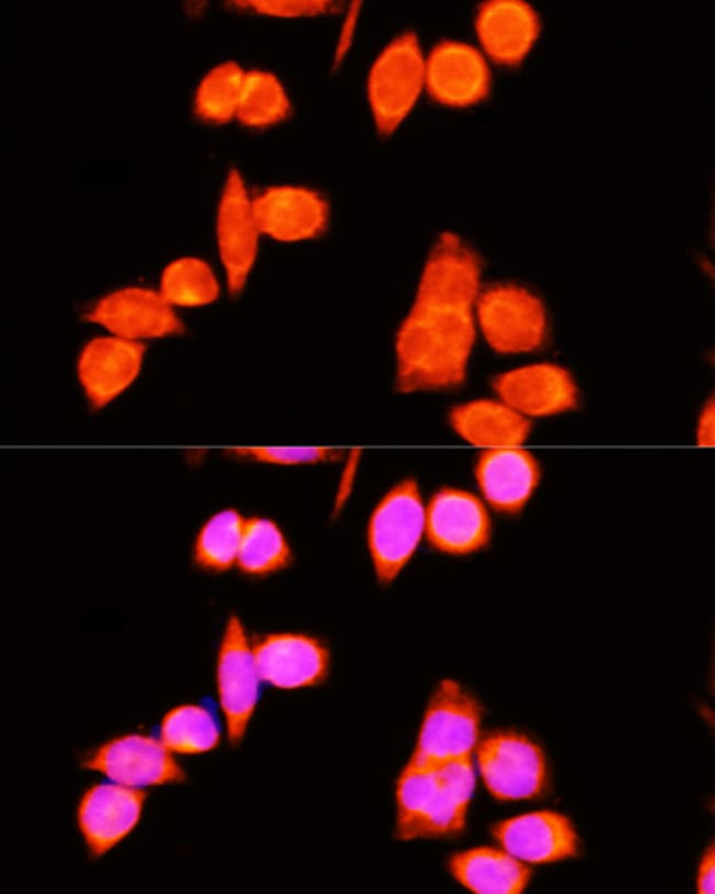 100UL DNAJC19 ANTIBODY 100 ul