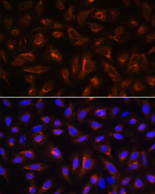 100UL ARL13B ANTIBODY 100 ul