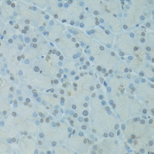 100UL GTF2H2C ANTIBODY 100 ul
