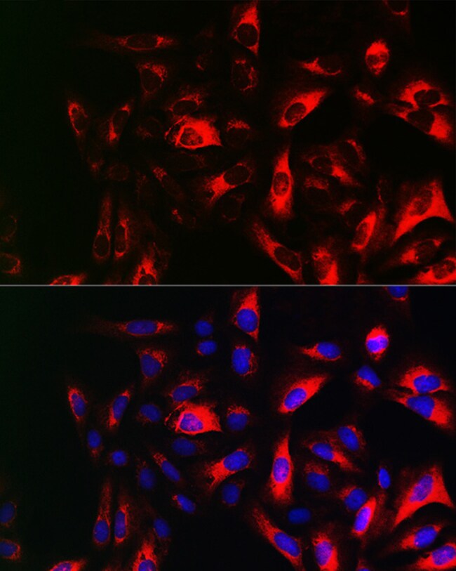 100 ul RRM2 Polyclonal Antibody