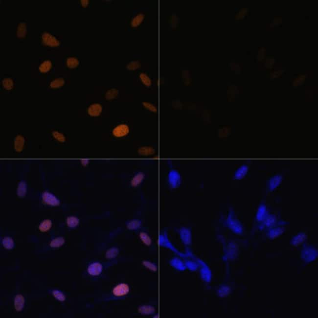 100UL ACETYL-HISTONE H4 (LYS16) ANTI 100