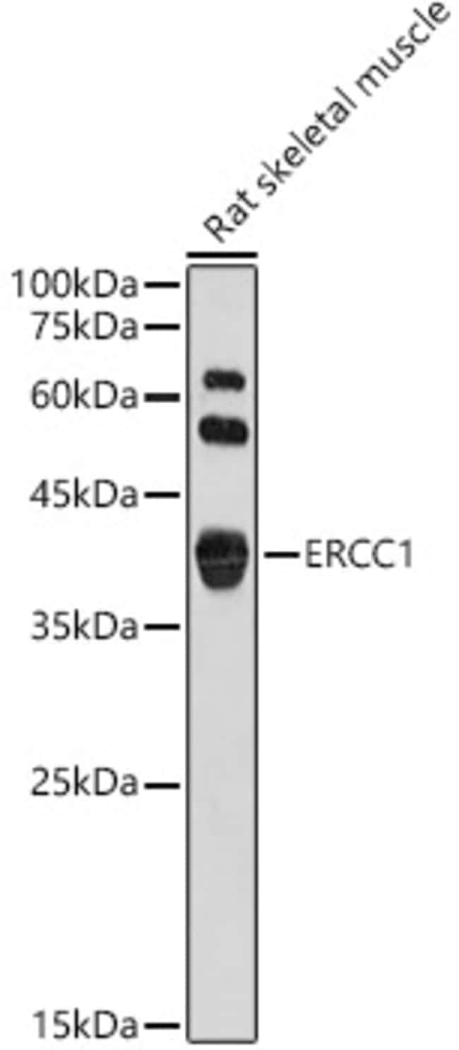 100UL ERCC1 ANTIBODY 100 ul
