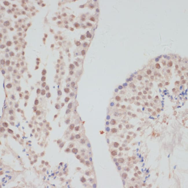 100UL CYCLIN G1 ANTIBODY 100 ul