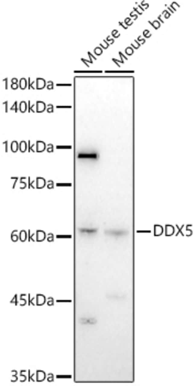 100UL DDX5 ANTIBODY 100 ul