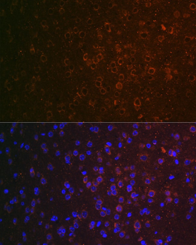 100UL ABAT ANTIBODY 100 ul
