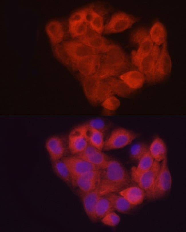 100UL AHCY ANTIBODY 100 ul