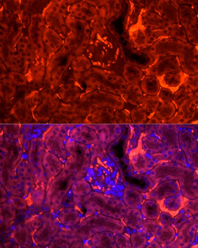 100UL FABP3 ANTIBODY 100 ul