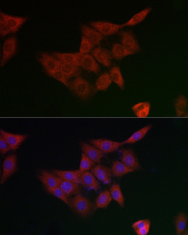100UL GCLM ANTIBODY 100 ul