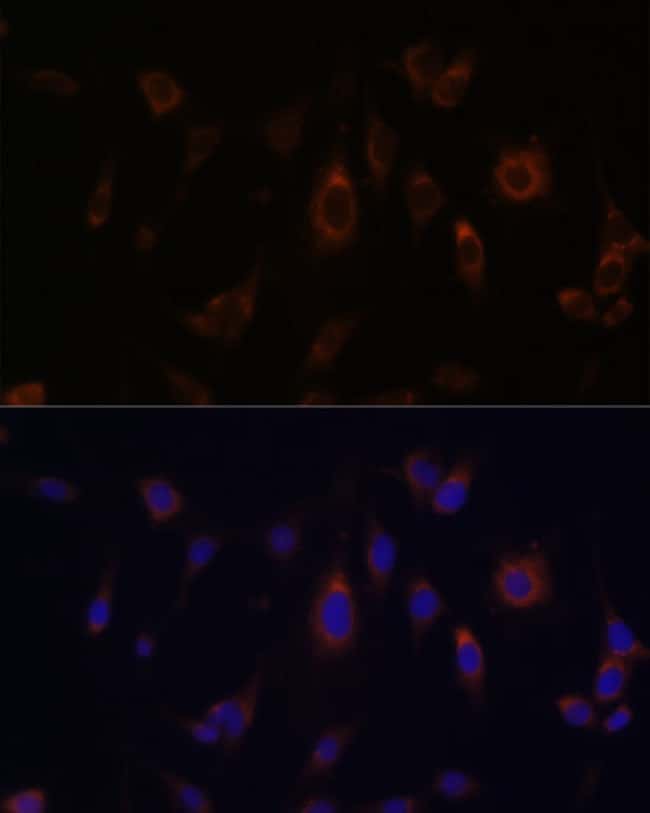 100UL GLRX ANTIBODY 100 ul