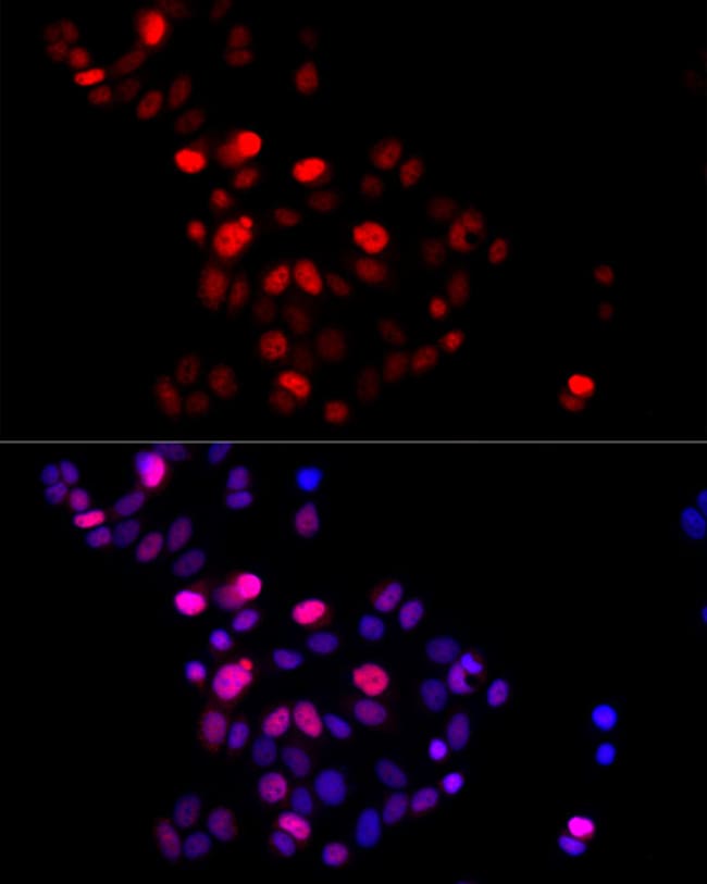 100UL GMNN ANTIBODY 100 ul