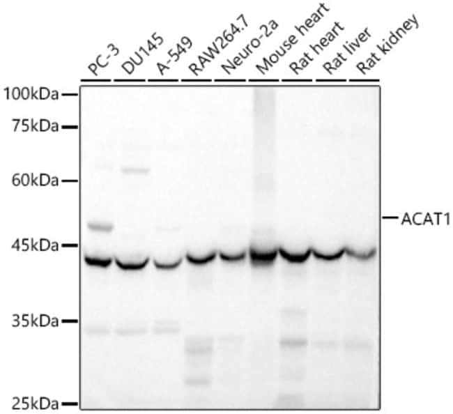 100UL ACAT1 ANTIBODY 100 ul