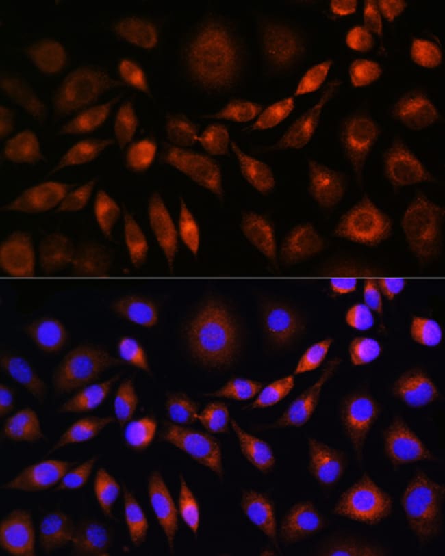100UL APOLIPOPROTEIN M ANTIBODY 100 ul