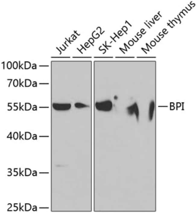 100UL BPI ANTIBODY 100 ul