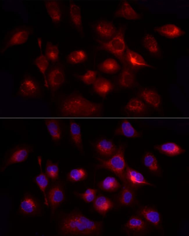 100UL GHRH ANTIBODY 100 ul