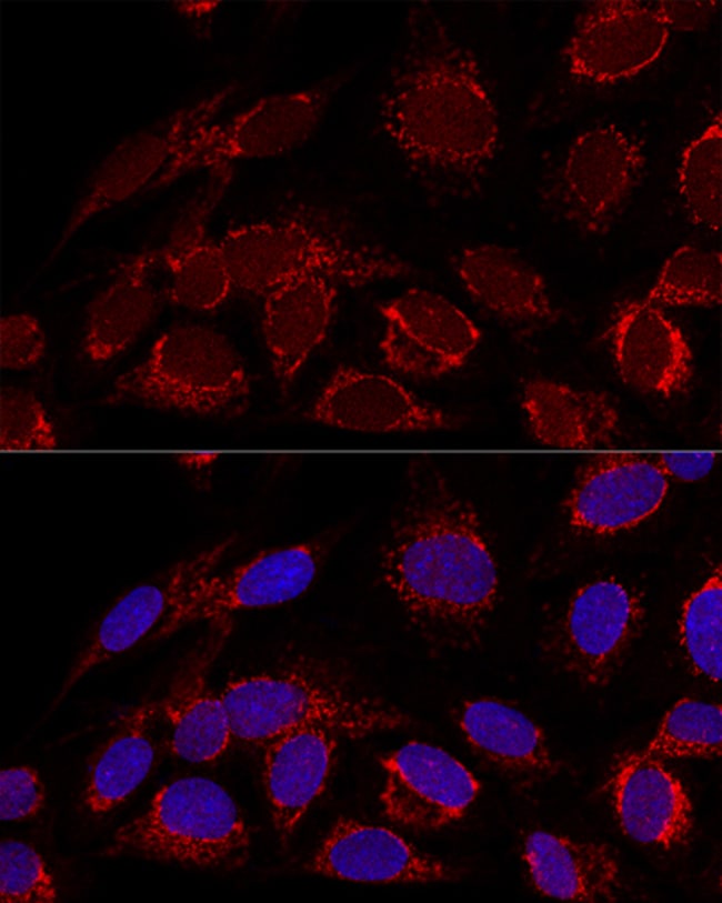 100UL HADHA ANTIBODY 100 ul