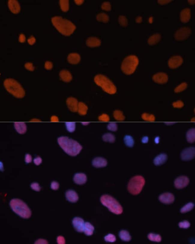 100UL HDGF ANTIBODY 100 ul