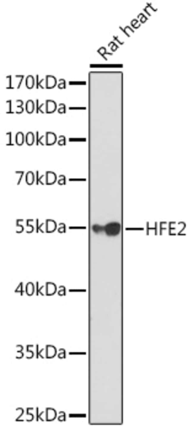 100UL HFE2 ANTIBODY 100 ul