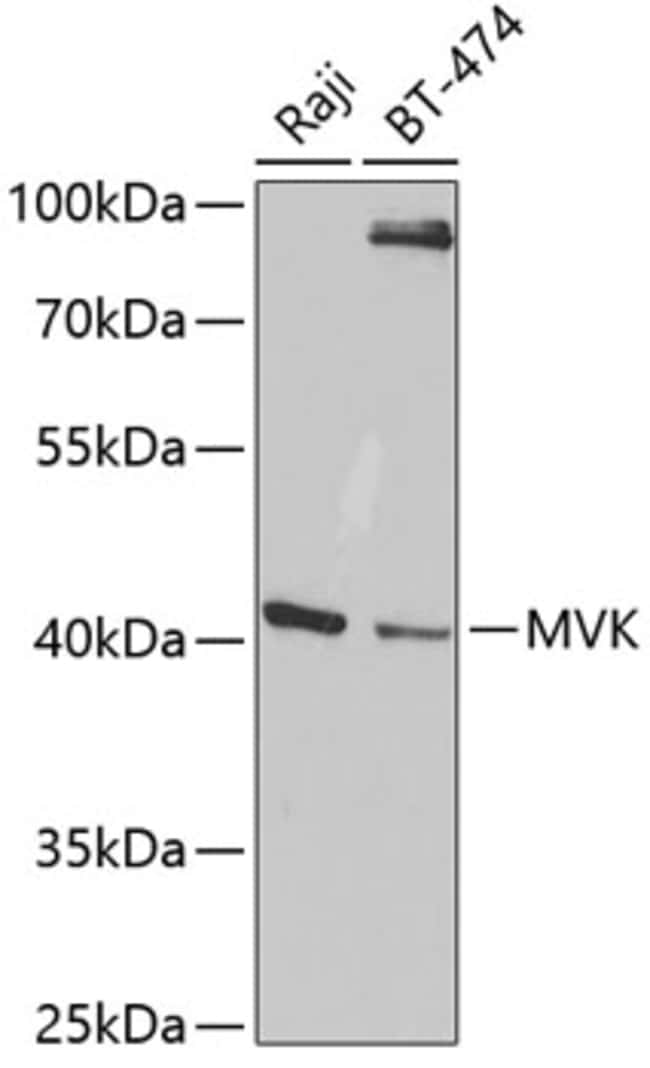 100UL MVK ANTIBODY 100 ul