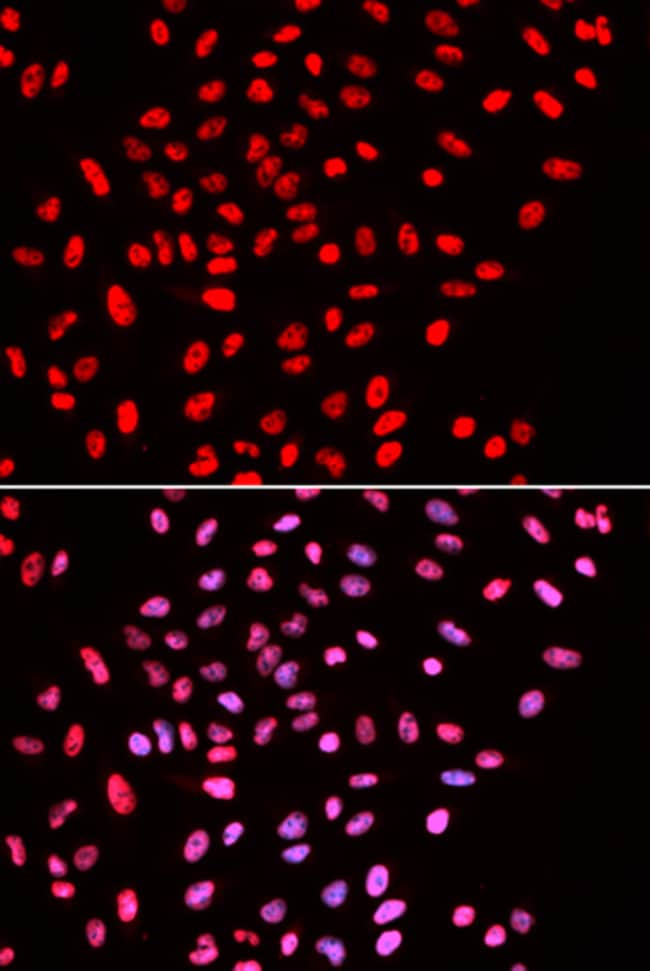100UL BAF57 ANTIBODY 100 ul