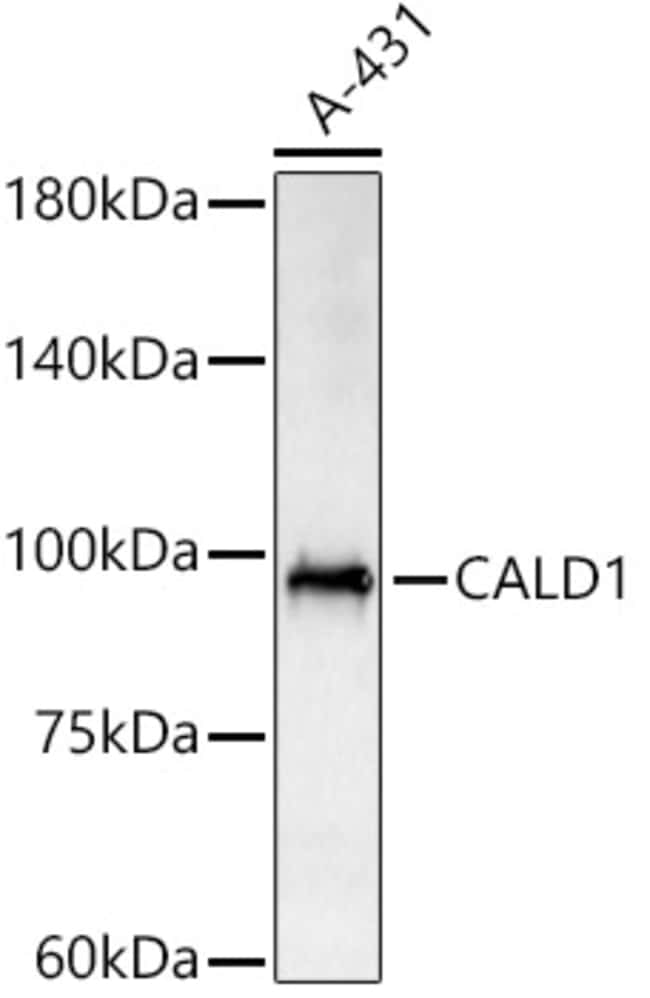 100UL CALDESMON ANTIBODY 100 ul